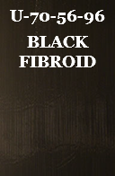 U-70-56-96 BLACK FIBROID 